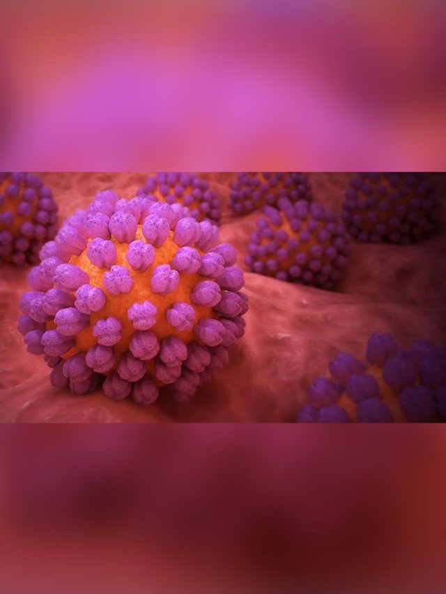 Understanding Norovirus: Symptoms, Prevention, and Management